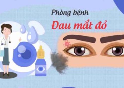 Phát thanh: Khuyến cáo phòng bệnh đau mắt đỏ