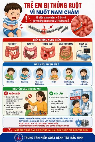 Infographic - Trẻ em bị thủng ruột vì nam châm